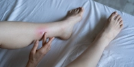 Bed Bug Treatment in Thunder Bay P7A 0A2